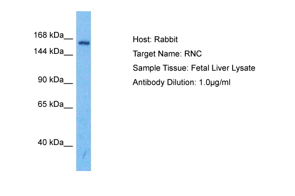 Host: Rabbit Target Name: DROSHA Sample Tissue: Human Fetal Liver Antibody Dilution: 1.0ug/ml
