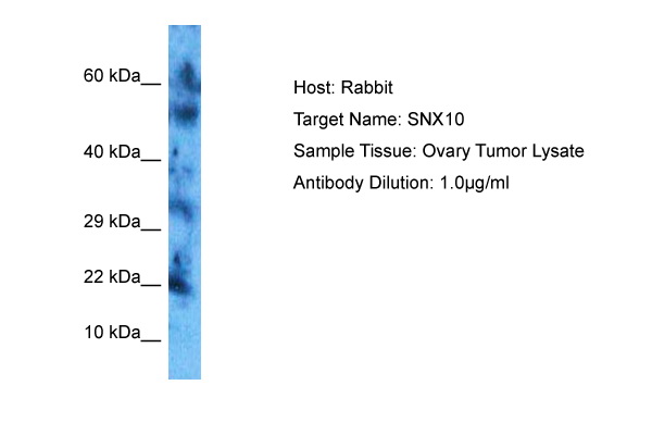 Host: Rabbit Target Name: SNX10 Sample Tissue: Human Ovary Tumor Antibody Dilution: 1.0ug/ml