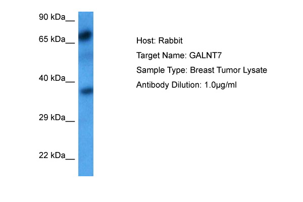 Host: Rabbit Target Name: GALNT7 Sample Tissue: Breast Tumor lysates Antibody Dilution: 1ug/ml