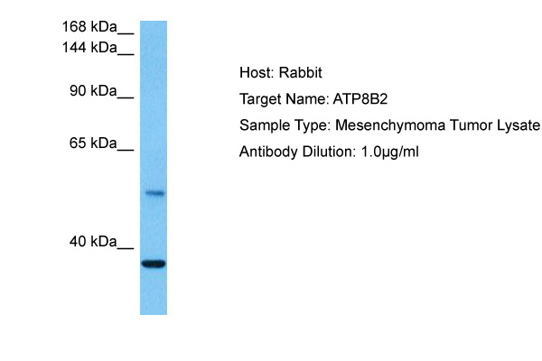 Host: Rabbit Target Name: ATP8B2 Sample Tissue: Human Mesenchymoma Tumor lysates Antibody Dilution: 1ug/ml