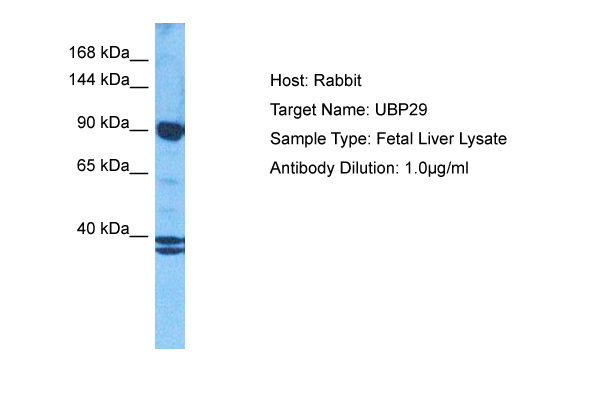 Host: Rabbit Target Name: USP29 Sample Tissue: Human Fetal Liver Antibody Dilution: 1.0ug/ml