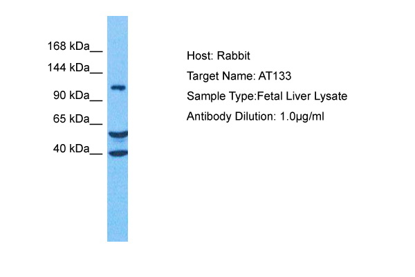 Host: Rabbit Target Name: ATP13A3 Sample Tissue: Human Fetal Liver Antibody Dilution: 1.0ug/ml