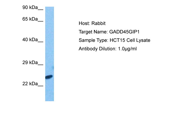 Host: Rabbit Target Name: GADD45GIP1 Sample Tissue: HCT15 Whole Cell lysates Antibody Dilution: 1.0ug/ml