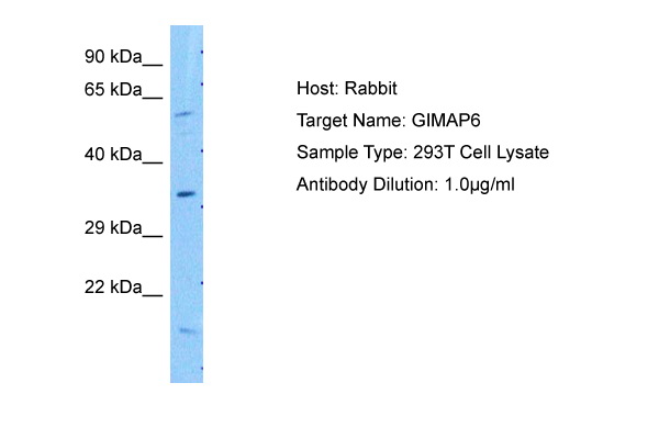 Host: Rabbit Target Name: GIMAP6 Sample Tissue: Human 293T Whole Cell Antibody Dilution: 1.0ug/ml