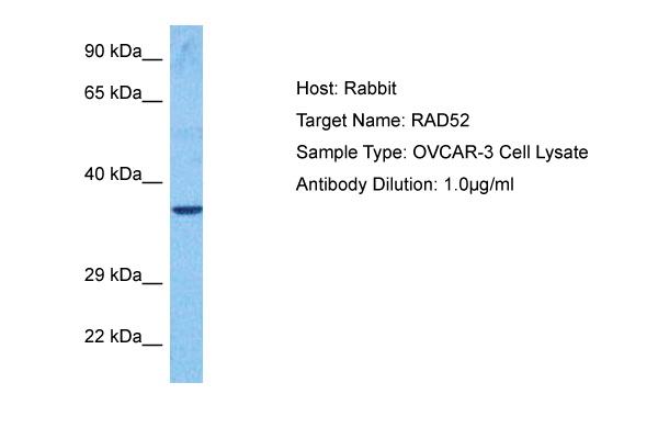 Western blot analysis using HRP antibody Cat.-No AM06196SU-N against f ull-length HRP recombinant protein.