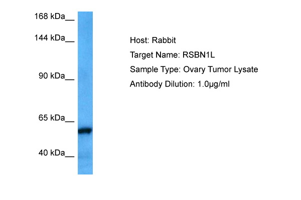 Host: Rabbit Target Name: RSBN1L Sample Tissue: Human Ovary Tumor lysates Antibody Dilution: 1ug/ml