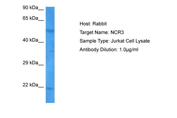 Host: Rabbit Target Name: NCR3 Sample Tissue: Jurkat Whole Cell lysates Antibody Dilution: 1ug/ml