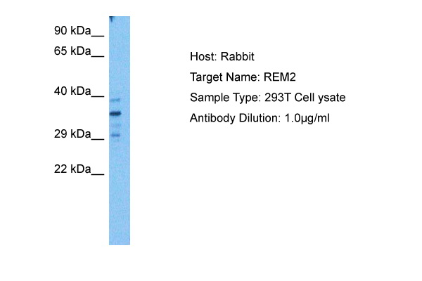 Western blot analysis using beta-Actin antibody Cat.-No AM06276SU-N against NIH/3T3 (Lane 1), Jurkat (Lane 2), Hela (Lane 3), CHO (Lane 4), PC12 (Lane 5), HEK293 (Lane 6), COS (Lane 7), A549 (Lane 8) and MCF-7 (Lane 9) cell lysate.