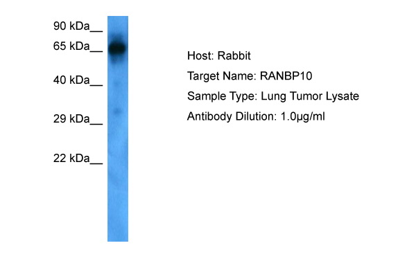 Host: Rabbit Target Name: RANBP10 Sample Tissue: Human Lung Tumor Antibody Dilution: 1.0ug/ml