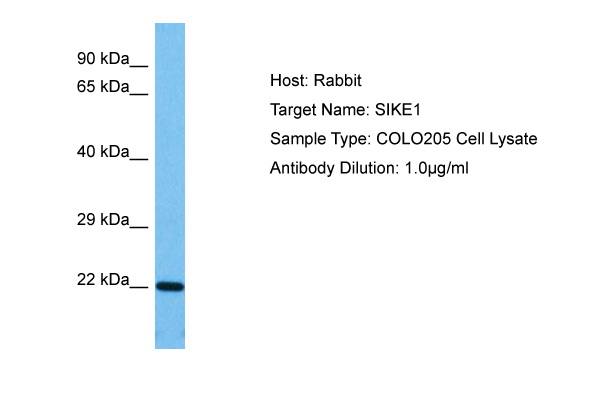 Host: Rabbit Target Name: SIKE1 Sample Tissue: Human COLO205 Whole Cell lysates Antibody Dilution: 1ug/ml