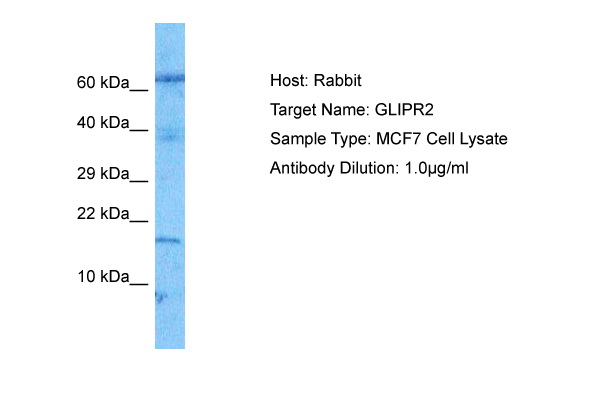Host: Rabbit Target Name: GLIPR2 Sample Tissue: MCF7 Whole Cell lysates Antibody Dilution: 1.0ug/ml