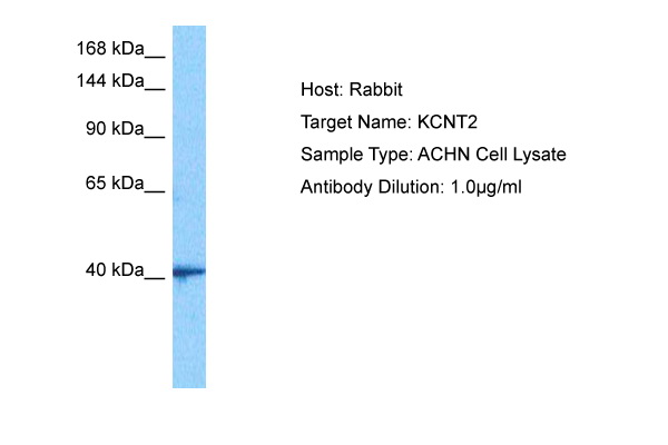 Host: Rabbit Target Name: KCNT2 Sample Tissue: Human ACHN Whole Cell lysates Antibody Dilution: 1ug/ml