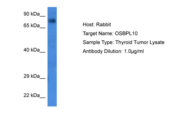 Host: Rabbit Target Name: OSBPL10 Sample Tissue: Human Thyroid Tumor lysates Antibody Dilution: 1ug/ml