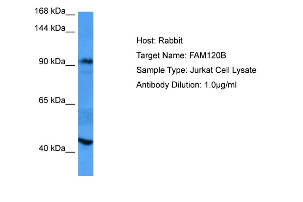 Host: Rabbit Target Name: FAM120B Sample Tissue: Human Jurkat Whole Cell lysates Antibody Dilution: 1ug/ml