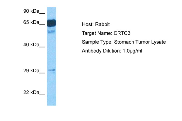 Host: Rabbit Target Name: CRTC3 Sample Tissue: Stomach Tumor lysates Antibody Dilution: 1ug/ml