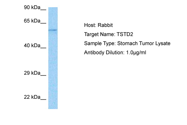 Host: Rabbit Target Name: TSTD2 Sample Tissue: Stomach Tumor lysates Antibody Dilution: 1ug/ml