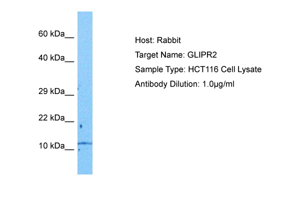Host: Rabbit Target Name: GLIPR2 Sample Tissue: Human HCT116 Whole Cell lysates Antibody Dilution: 1ug/ml