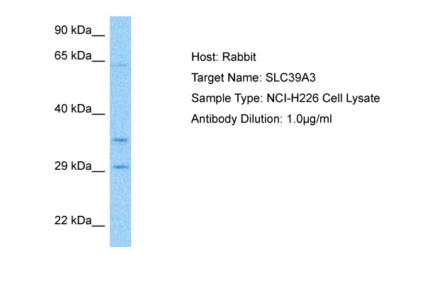 Host: Rabbit Target Name: SLC39A3 Sample Tissue: Human NCI-H226 Whole Cell lysates Antibody Dilution: 1ug/ml