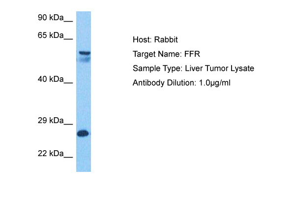 Host: Rabbit Target Name: FFR Sample Tissue: Human Liver Tumor lysates Antibody Dilution: 1ug/ml