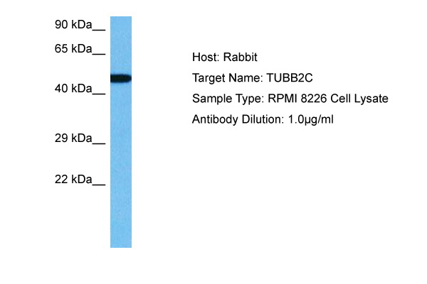 Host: Rabbit Target Name: TUBB2C Sample Tissue: Human RPMI 8226 Whole Cell lysates Antibody Dilution: 1ug/ml