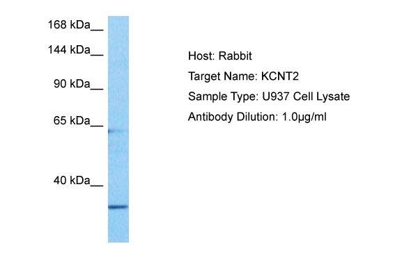Host: Rabbit Target Name: KCNT2 Sample Tissue: Human U937 Whole Cell lysates Antibody Dilution: 1ug/ml