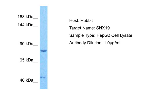Western blot analysis using SIRT1 antibody Cat.-No AM06495SU-N against MCF-7 (1), Jurkat (2), Hela (3), HEK293 (4) and A549 (5) cell lysate.