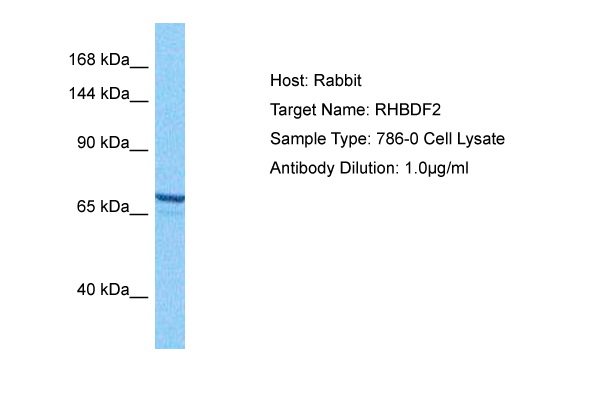 Western blot analysis using CRTC2 antibody Cat.-No AM06534SU-N against Hela (1) and HEK293 (2) cell lysate.