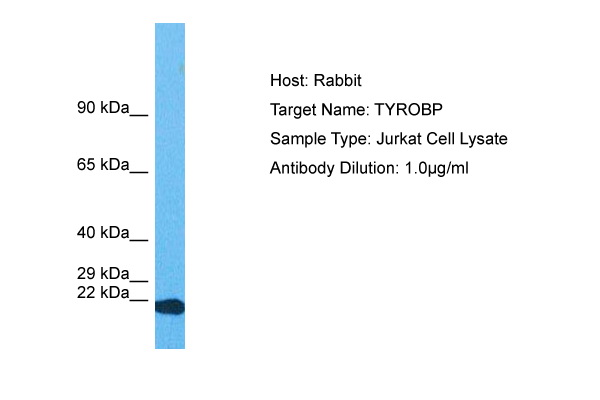 Host: Rabbit Target Name: TYROBP Sample Tissue: Human Jurkat Whole Cell lysates Antibody Dilution: 1ug/ml