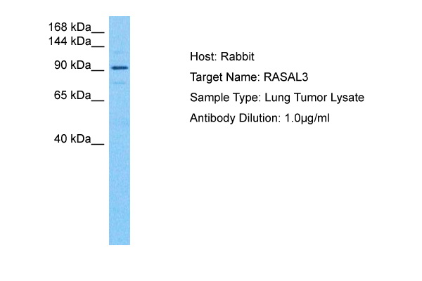 Host: Rabbit Target Name: RASAL3 Sample Tissue: Human Lung Tumor lysates Antibody Dilution: 1ug/ml