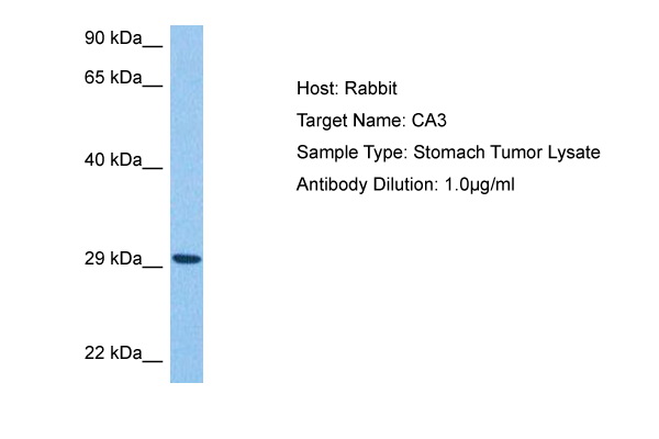 Western blot analysis using SMAD5 antibody Cat.-No AM06562SU-N against Hela (1), SK-N-SH (2), PC-12 (3), Jurkat (4), and K562 (5) cell lysate.