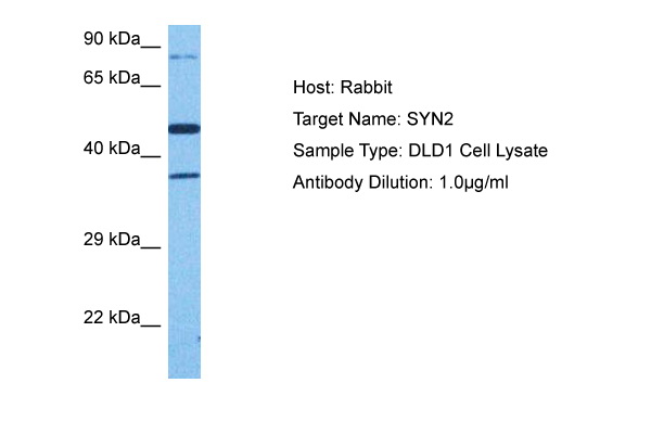 Host: Rabbit Target Name: SYN2 Sample Tissue: Human DLD1 Whole Cell lysates Antibody Dilution: 1ug/ml