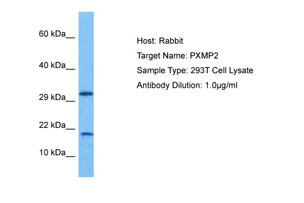 Western blot analysis using ACTA2 antibody Cat.-No AM06574SU-N against Hela (1), Jurkta (2), HepG2 (3), MCF-7 (4), A431 (5), A549 (6), PC-12 (7), NIH/3T3 (8) and Cos7 (9) cell lysate.