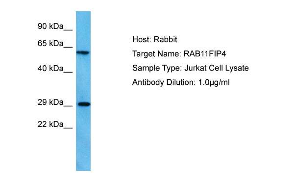 Host: Rabbit Target Name: RAB11FIP4 Sample Tissue: Human Jurkat Whole Cell lysates Antibody Dilution: 1ug/ml