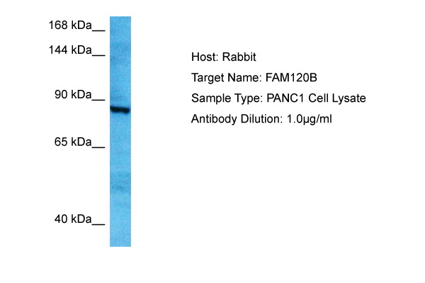 Host: Rabbit Target Name: FAM120B Sample Tissue: Human PANC1 Whole Cell lysates Antibody Dilution: 1ug/ml