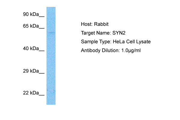 Host: Rabbit Target Name: SYN2 Sample Tissue: Human HeLa Whole Cell lysates Antibody Dilution: 1ug/ml