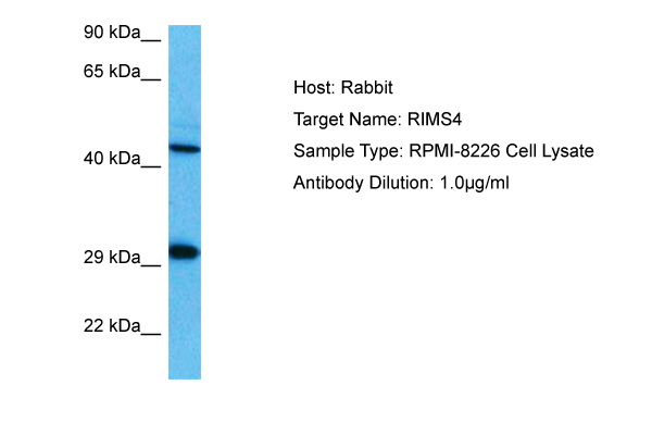 Host: Rabbit Target Name: RIMS4 Sample Tissue: Human RPMI 8226 Whole Cell lysates Antibody Dilution: 1ug/ml