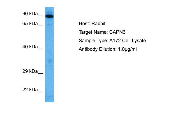 Western blot analysis using UBE2I mAb against human UBE2I (AA: 1-158) recombinant protein. (Expected MW is 45.3 kDa)
