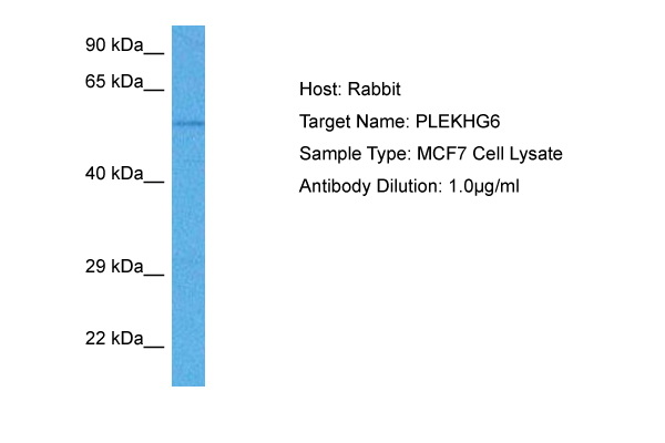 Host: Rabbit Target Name: PLEKHG6 Sample Tissue: Human MCF7 Whole Cell lysates Antibody Dilution: 1ug/ml