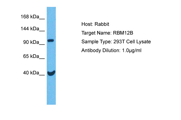 Host: Rabbit Target Name: RBM12B Sample Tissue: Human 293T Whole Cell lysates Antibody Dilution: 1ug/ml