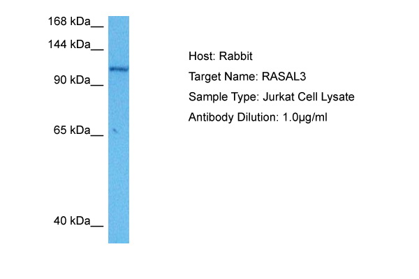 Host: Rabbit Target Name: RASAL3 Sample Tissue: Human Jurkat Whole Cell lysates Antibody Dilution: 1ug/ml