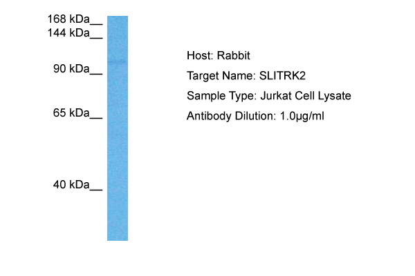 Host: Rabbit Target Name: SLITRK2 Sample Tissue: Human Jurkat Whole Cell lysates Antibody Dilution: 1ug/ml