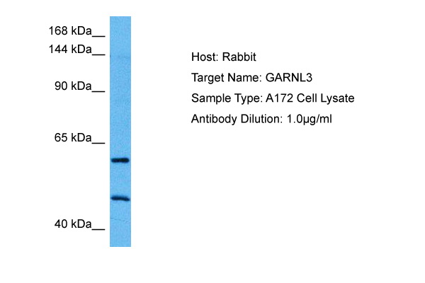 Host: Rabbit Target Name: GARNL3 Sample Tissue: Human A172 Whole Cell lysates Antibody Dilution: 1ug/ml