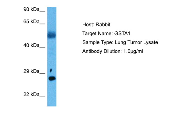 Western blot analysis using ASS1 antibody against human ASS1 (AA: 40-236) recombinant protein (Expected MW is 47 kDa).