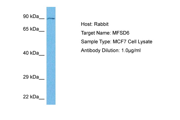 Host: Rabbit Target Name: MFSD6 Sample Tissue: Human MCF7 Whole Cell lysates Antibody Dilution: 1ug/ml