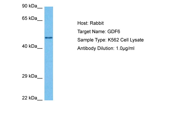 Western blot analysis using ALPL antibody against Human ALPL (AA: 18-502) recombinant protein (Expected MW is 78.9 kDa).