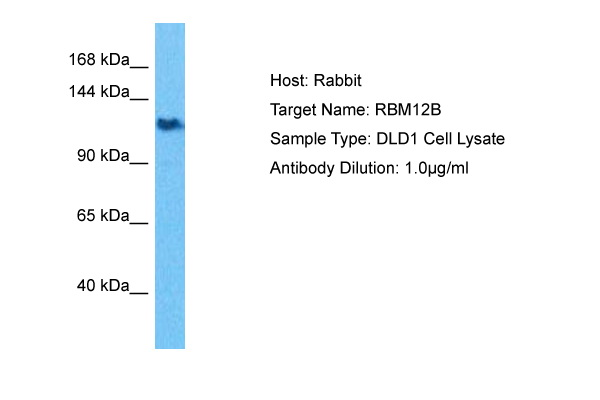 Host: Rabbit Target Name: RBM12B Sample Tissue: Human DLD1 Whole Cell lysates Antibody Dilution: 1ug/ml
