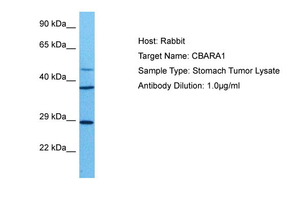 Host: Rabbit Target Name: CBARA1 Sample Tissue: Human Stomach Tumor lysates Antibody Dilution: 1ug/ml