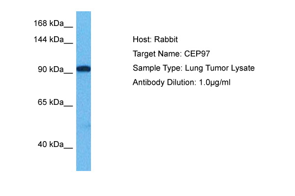 Host: Rabbit Target Name: CEP97 Sample Tissue: Human Lung Tumor lysates Antibody Dilution: 1ug/ml