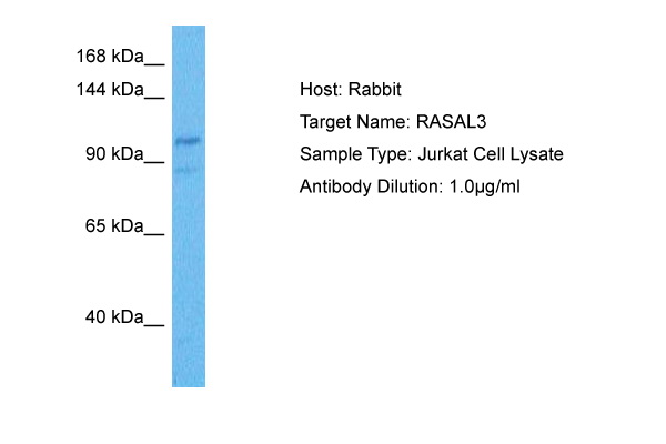 Host: Rabbit Target Name: RASAL3 Sample Tissue: Human Jurkat Whole Cell lysates Antibody Dilution: 1ug/ml