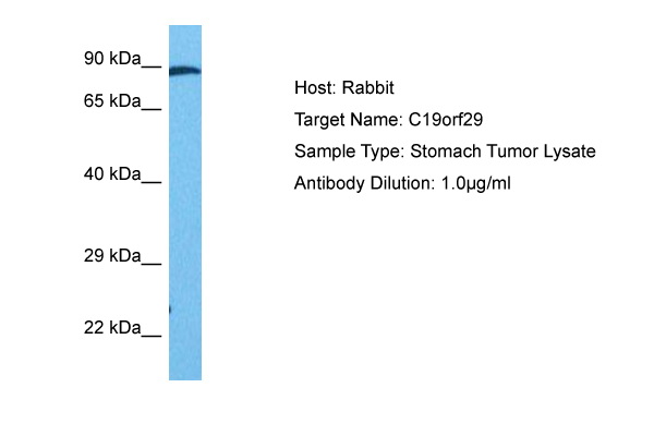 Host: Rabbit Target Name: C19ORF29 Sample Tissue: Human Stomach Tumor lysates Antibody Dilution: 1ug/ml
